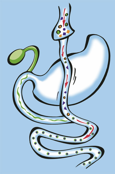 Laparoscopos Roux Y gastric bypass mtt