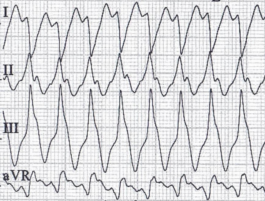 XVI_17index